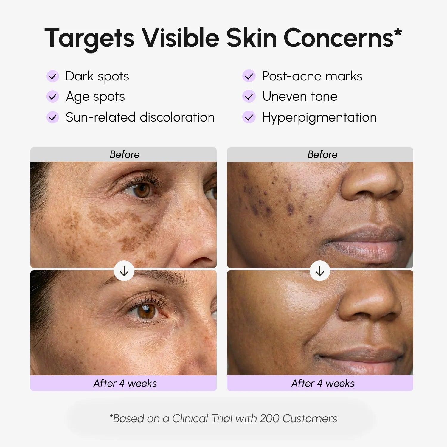 Dark Spot Correcting Face & Body Serum – Even Skin Tone